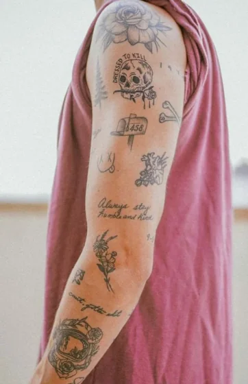 Arm